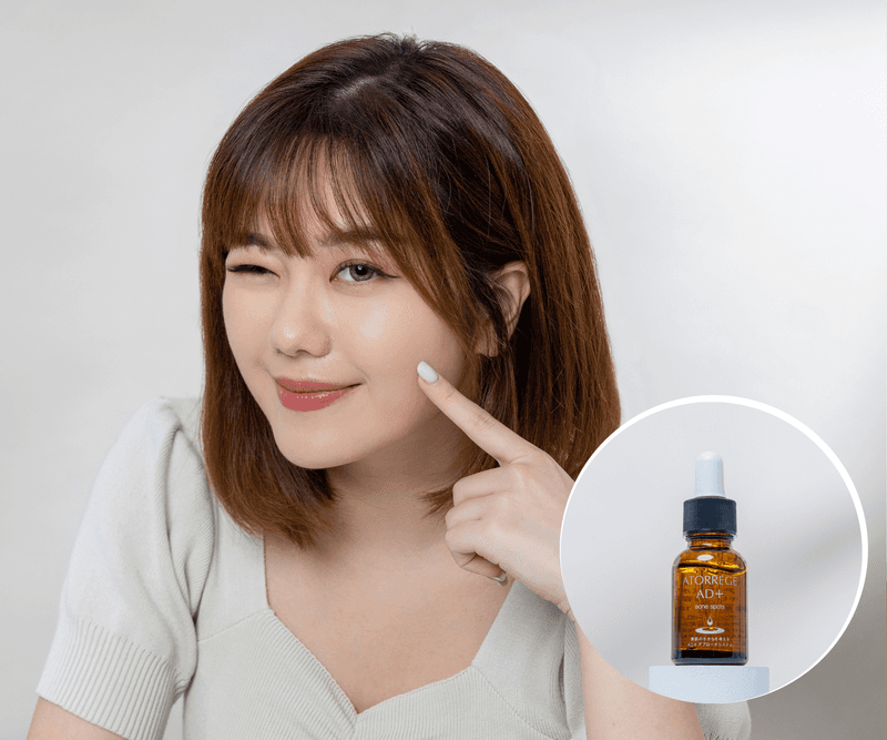 【Beauty Awards 2022】最喜愛淨痘精華大獎：ATORREGE AD+美肌淨痘精華  美編實測暗瘡一晚即謝？網上人氣口碑極高！敏感肌用戶表示很NICE！